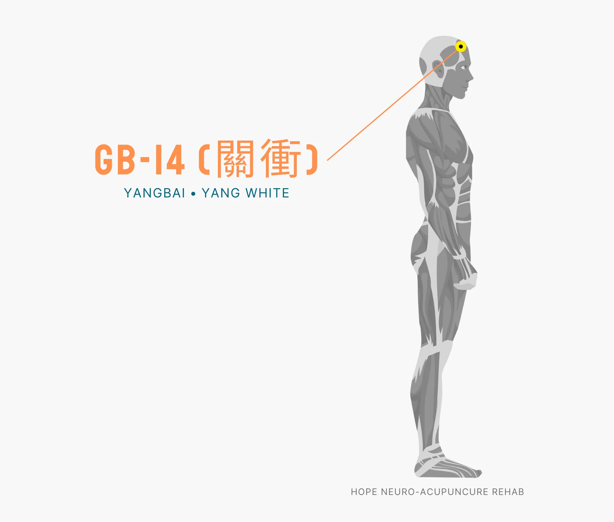 Diagram Showing Where the GB-14 Acupuncture Point (also known as Yangbai or Yang White) is within the Gallbladder Meridian