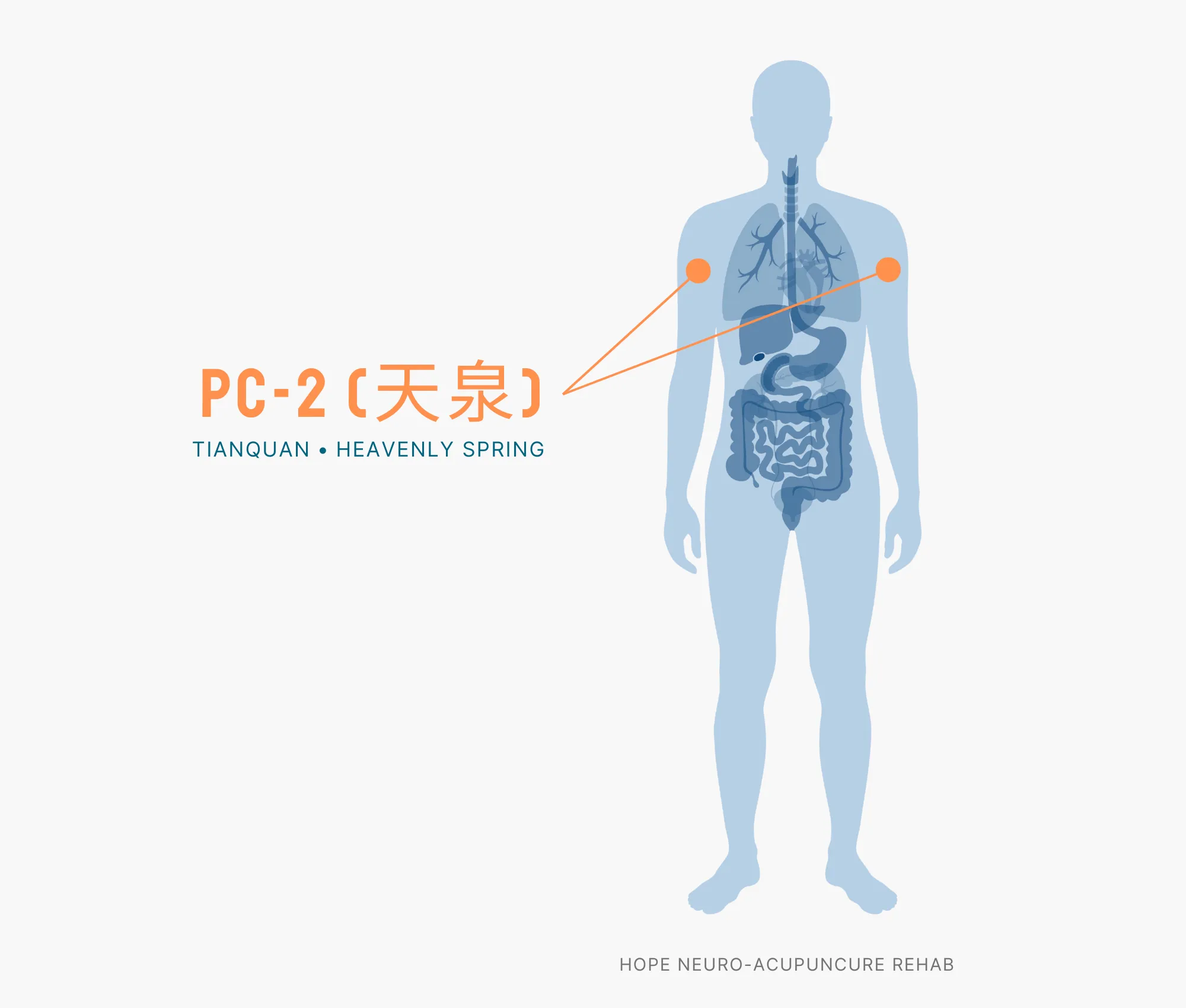 Diagram Showing Where the PC-2 Acupuncture Point (also known as Tianquan or Heavenly Spring) is within the Pericardium Meridian