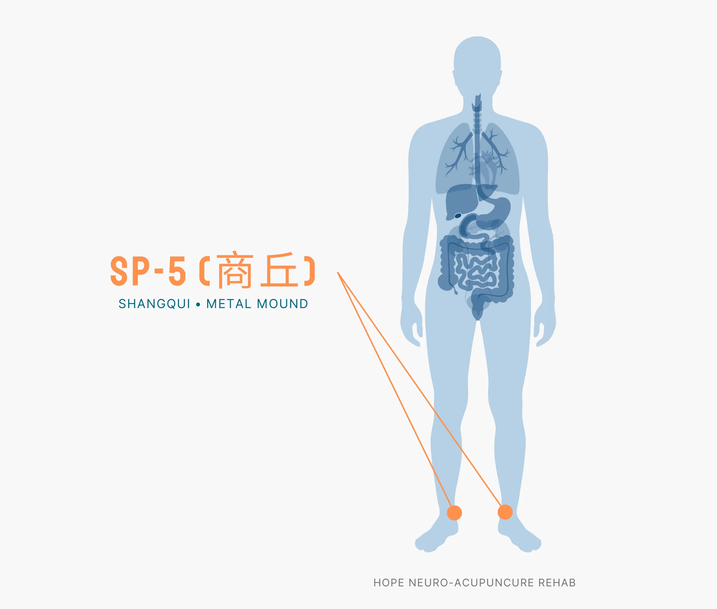 Diagram Showing Where the SP-5 Acupuncture Point (also known as Shangqui or Metal Mound) is within the Spleen Meridians