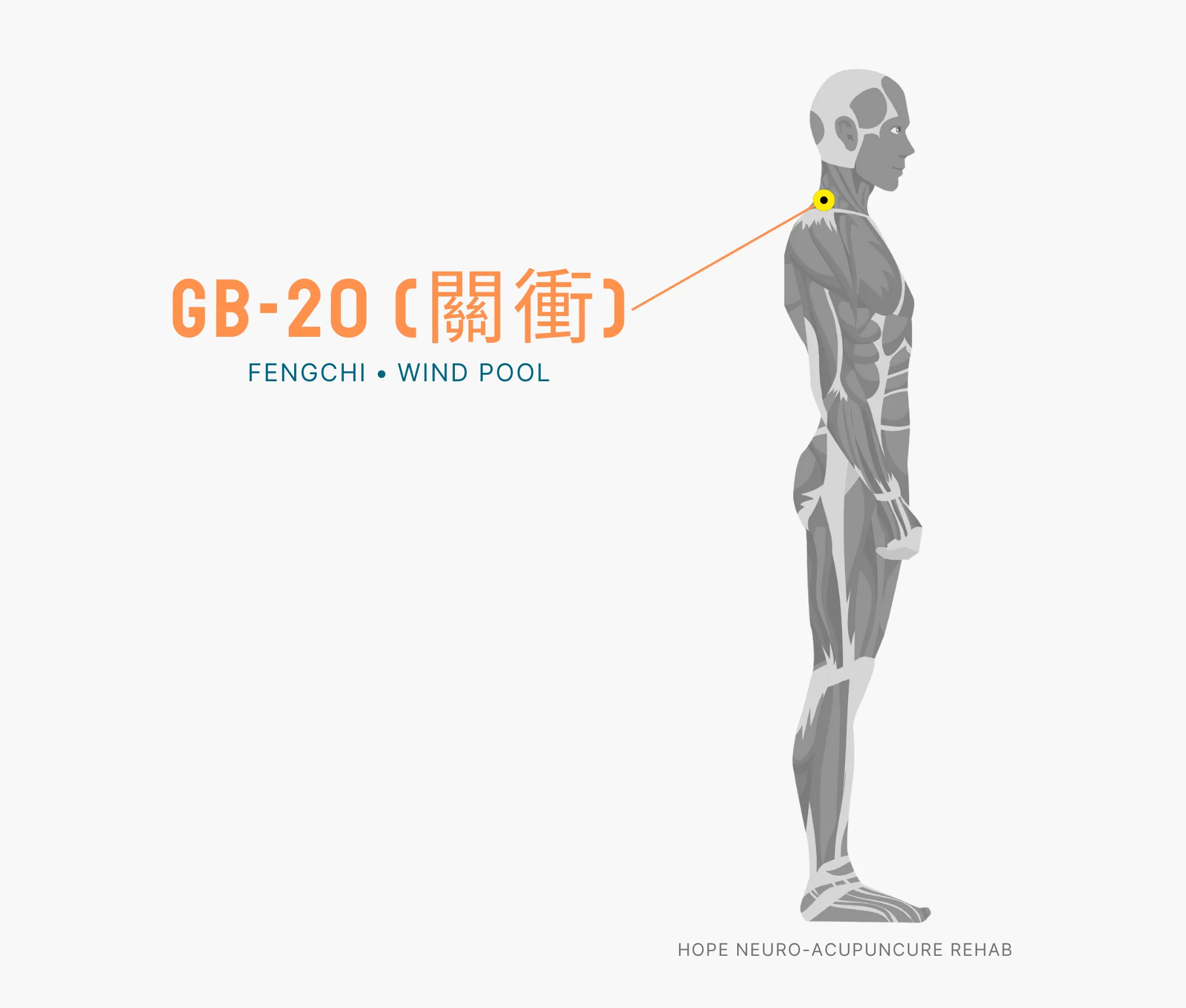 Diagram Showing Where the GB-20 Acupuncture Point (also known as Fengchi or Wind Pool) is within the Gallbladder Meridian