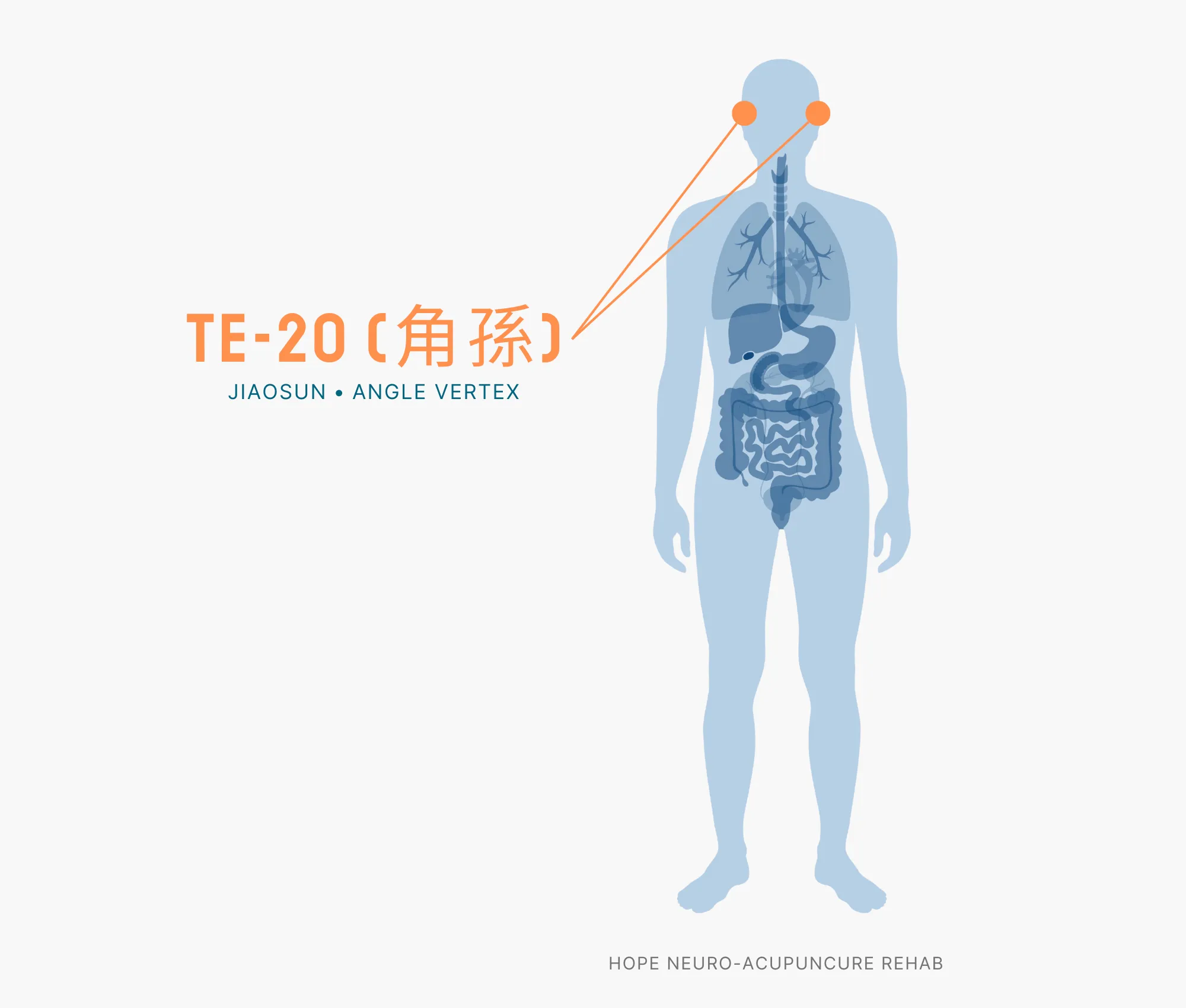 Diagram Showing Where the TE-20 Acupuncture Point (also known as Luxi or Head's Tranquility) is within the Triple Burner Meridian