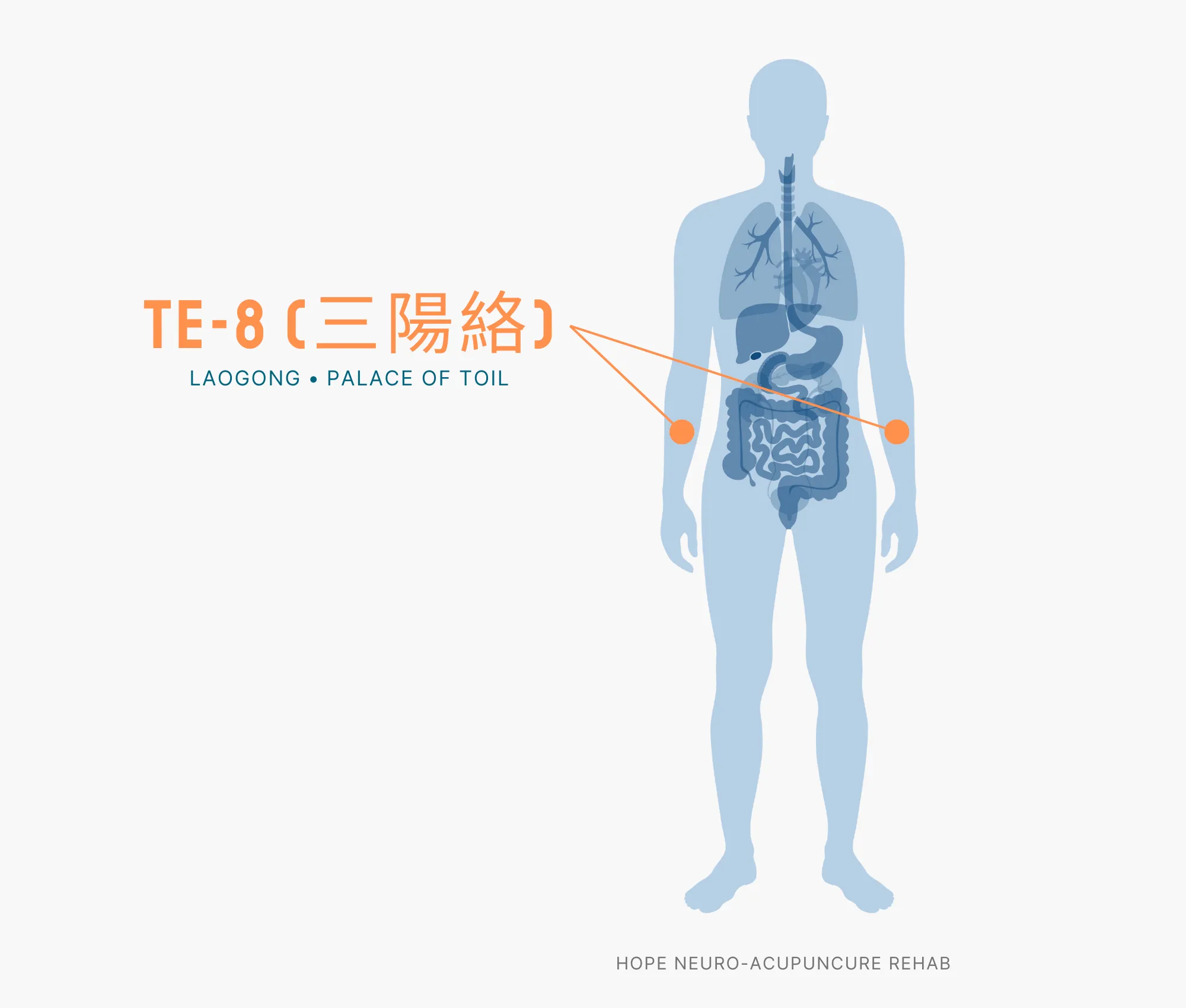 Diagram Showing Where the TE-8 Acupuncture Point (also known as Laogong or Palace of Toil) is within the Triple Burner Meridian