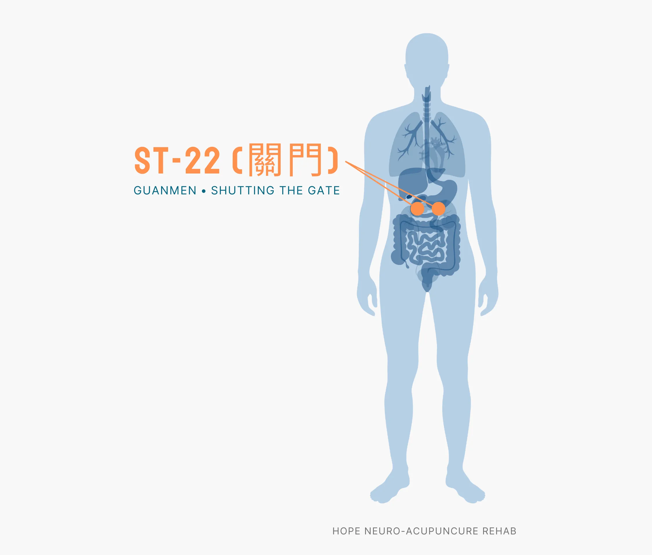 Diagram Showing Where the ST-22 Acupuncture Point (also known as Guanmen or Shutting the Gate) is within the Stomach Meridians