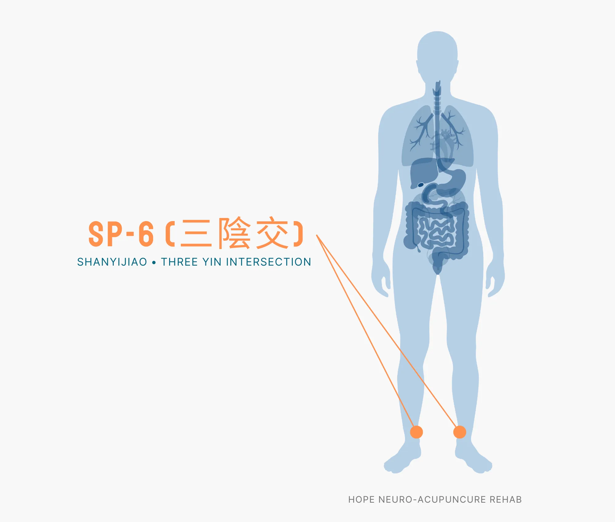 Diagram Showing Where the SP-6 Acupuncture Point (also known as Shanyijiao or Three Yin Intersection) is within the Spleen Meridians