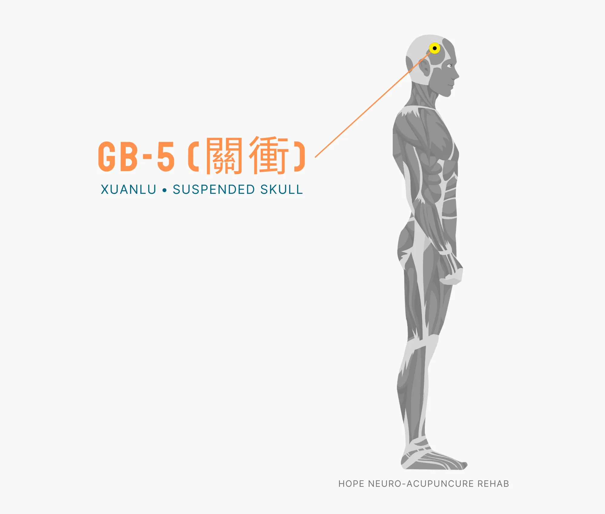 Diagram Showing Where the GB-1 Acupuncture Point (also known as (Tongziliao or Pupil Crevice) is within the Gallbladder Meridian