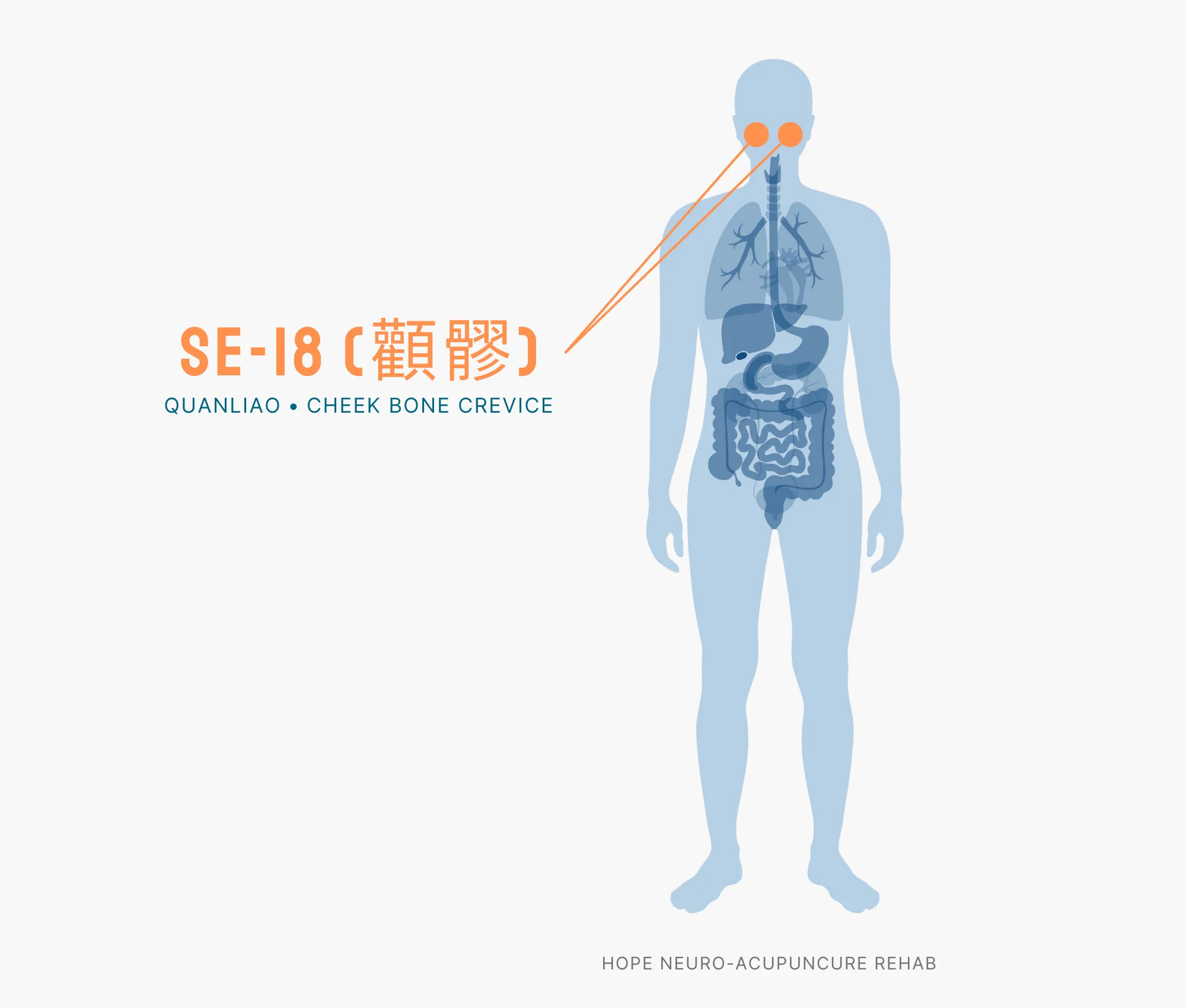 Diagram Showing Where the SI-18 Acupuncture Point (also known as Quanliao or Cheek Bone Crevice) is within the Small Intestine Meridians