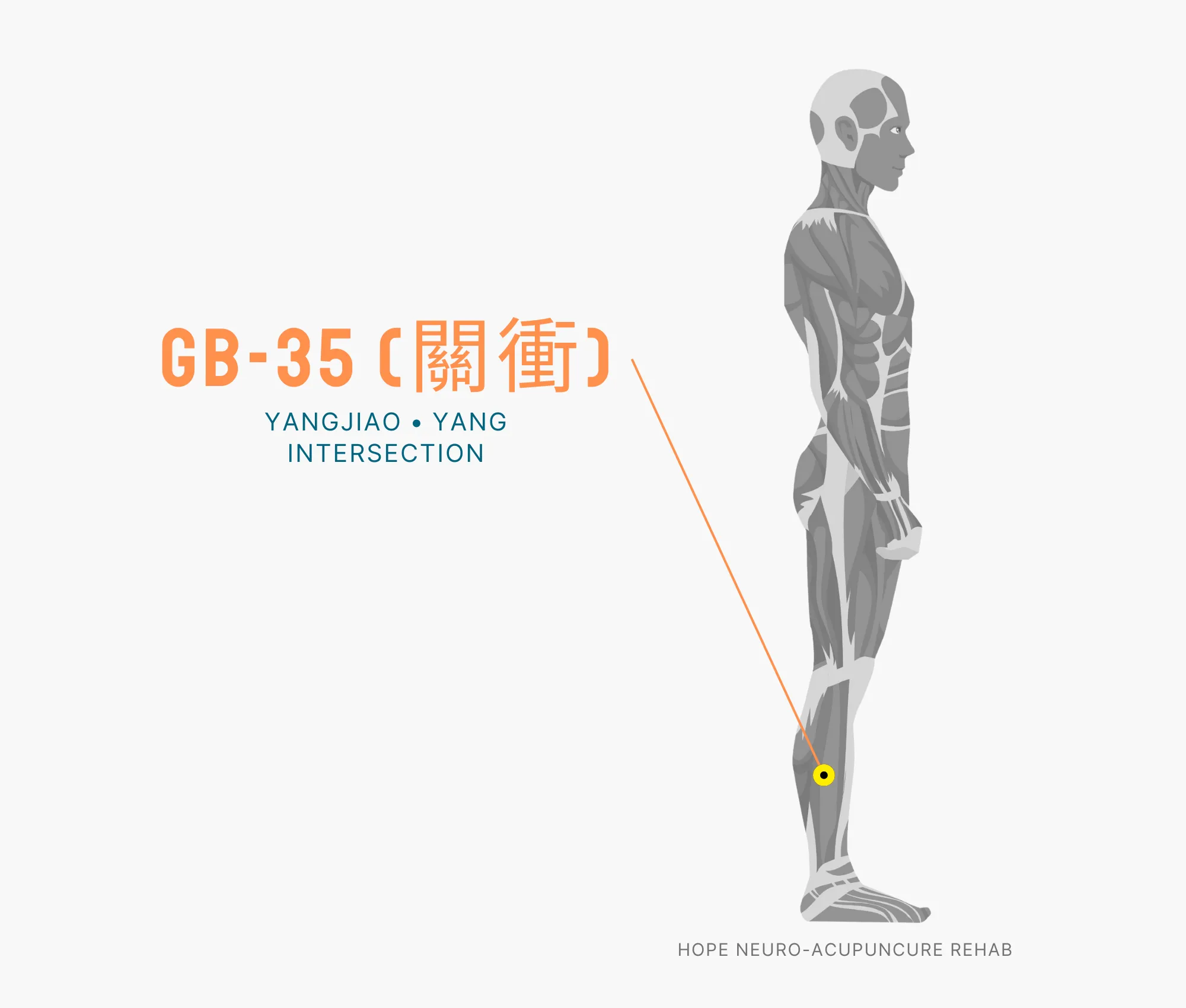 Diagram Showing Where the GB-35 Acupuncture Point (also known as Yangjiao or Yang Intersections) is within the Gallbladder Meridian