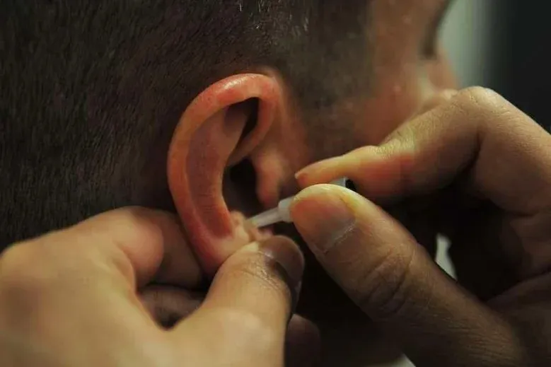 bfa needle applicator onto patient's ear