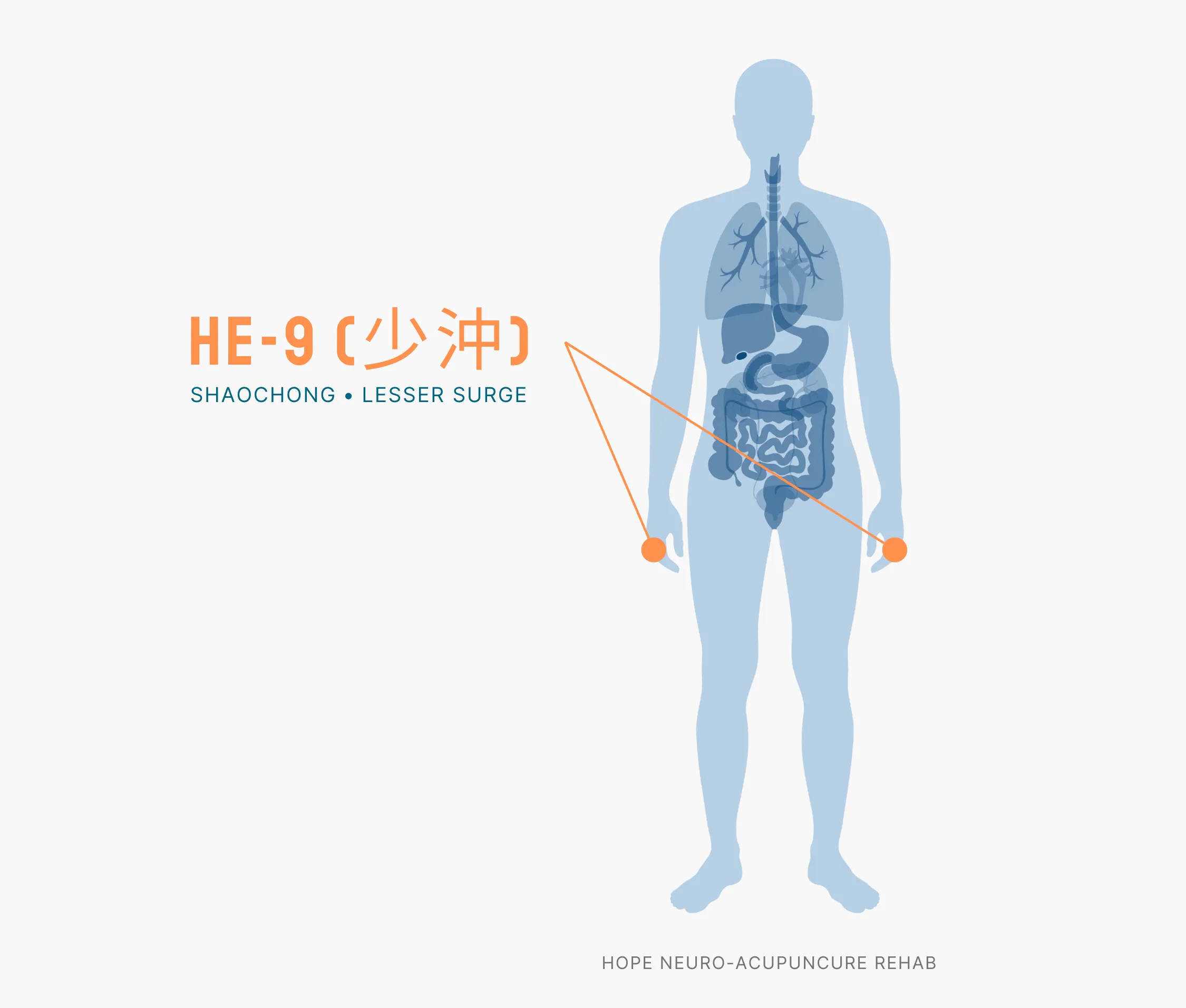 Diagram Showing Where the HE-9 Acupuncture Point (also known as Shaochong or Lesser Surge) is within the Heart Meridians