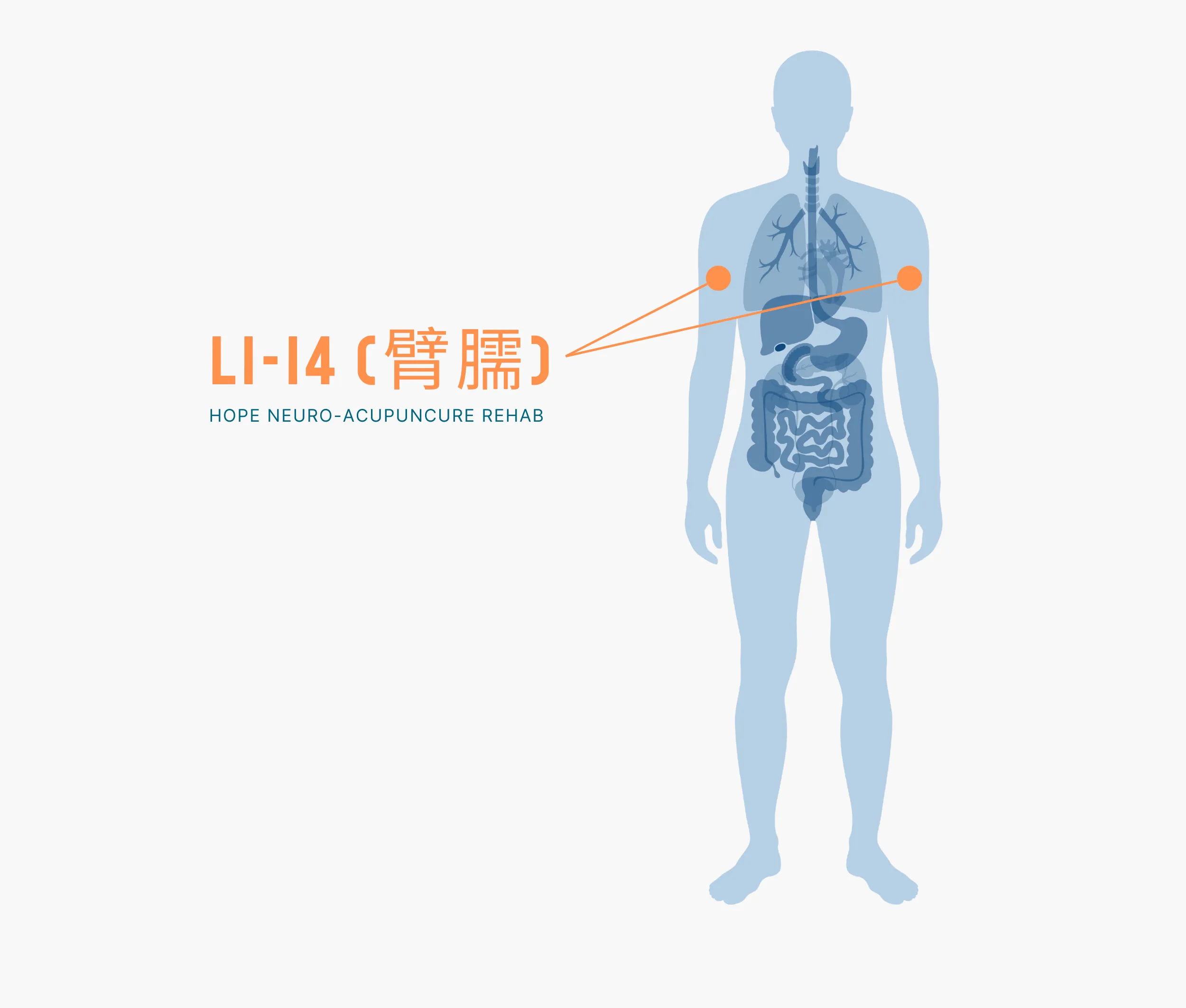 Diagram Showing Where the Li 14 Acupuncture Point is within the Large Intestine Meridians