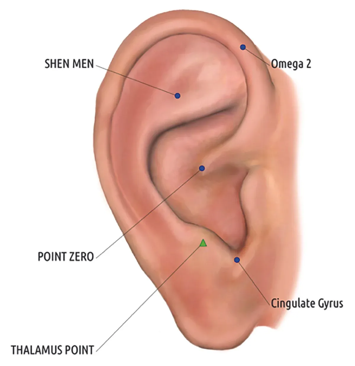 diagram of five points on the ear used for battlefield acupuncture