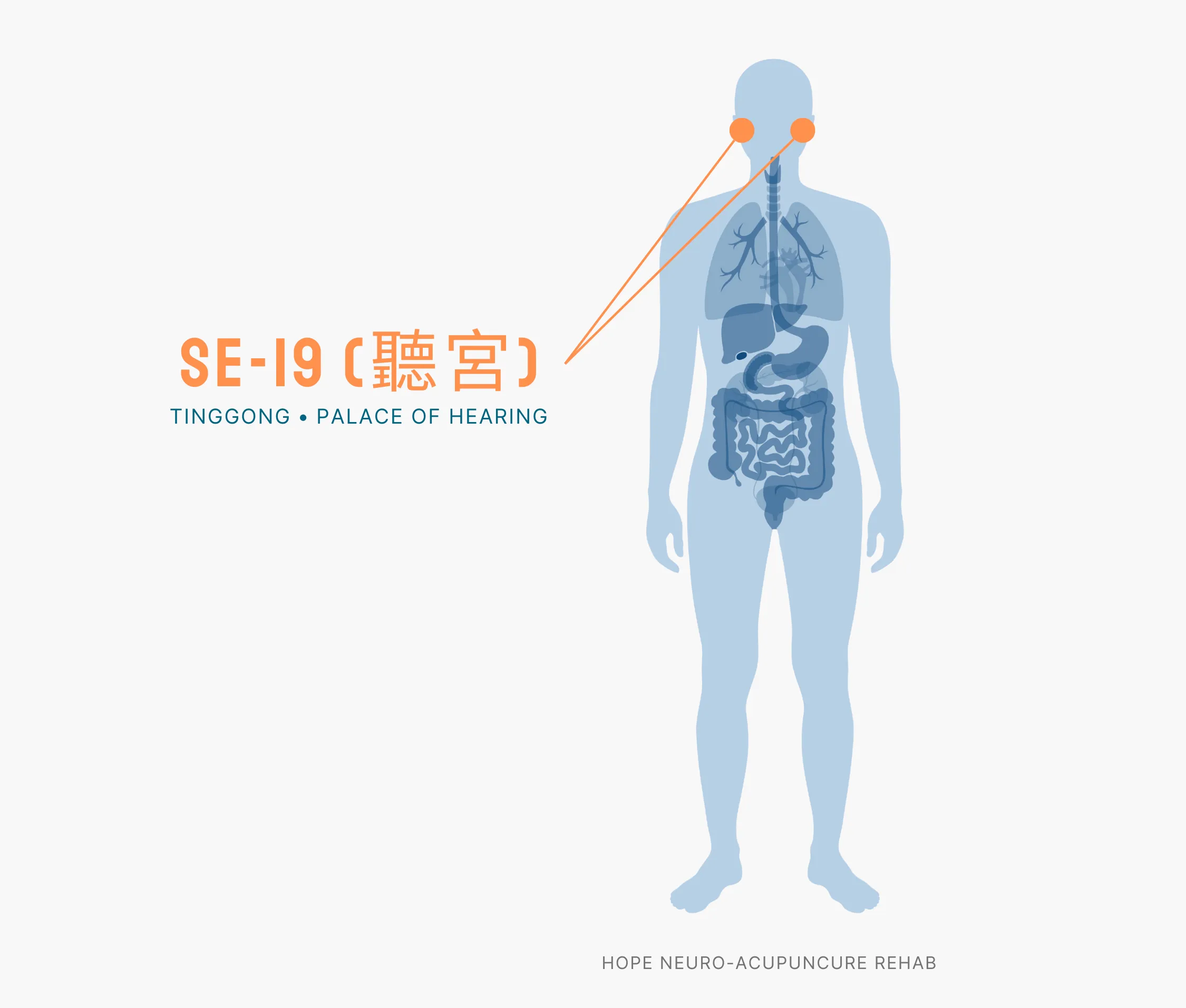 Diagram Showing Where the SI-19 Acupuncture Point (also known as Tinggong or Palace of Hearing) is within the Small Intestine Meridians