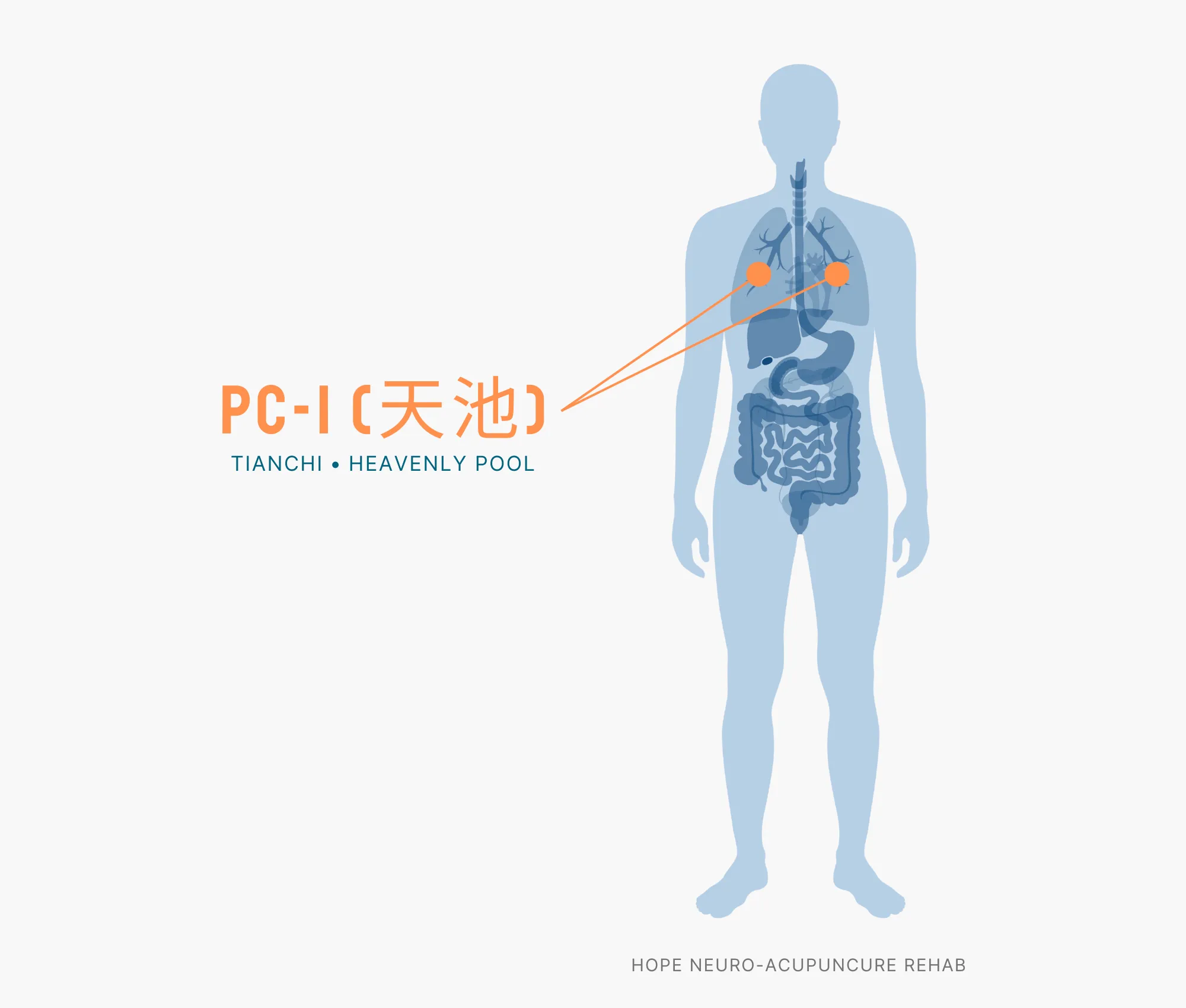 Diagram Showing Where the PC-1 Acupuncture Point (also known as Tianchi or Heavenly Pool) is within the Pericardium Meridian