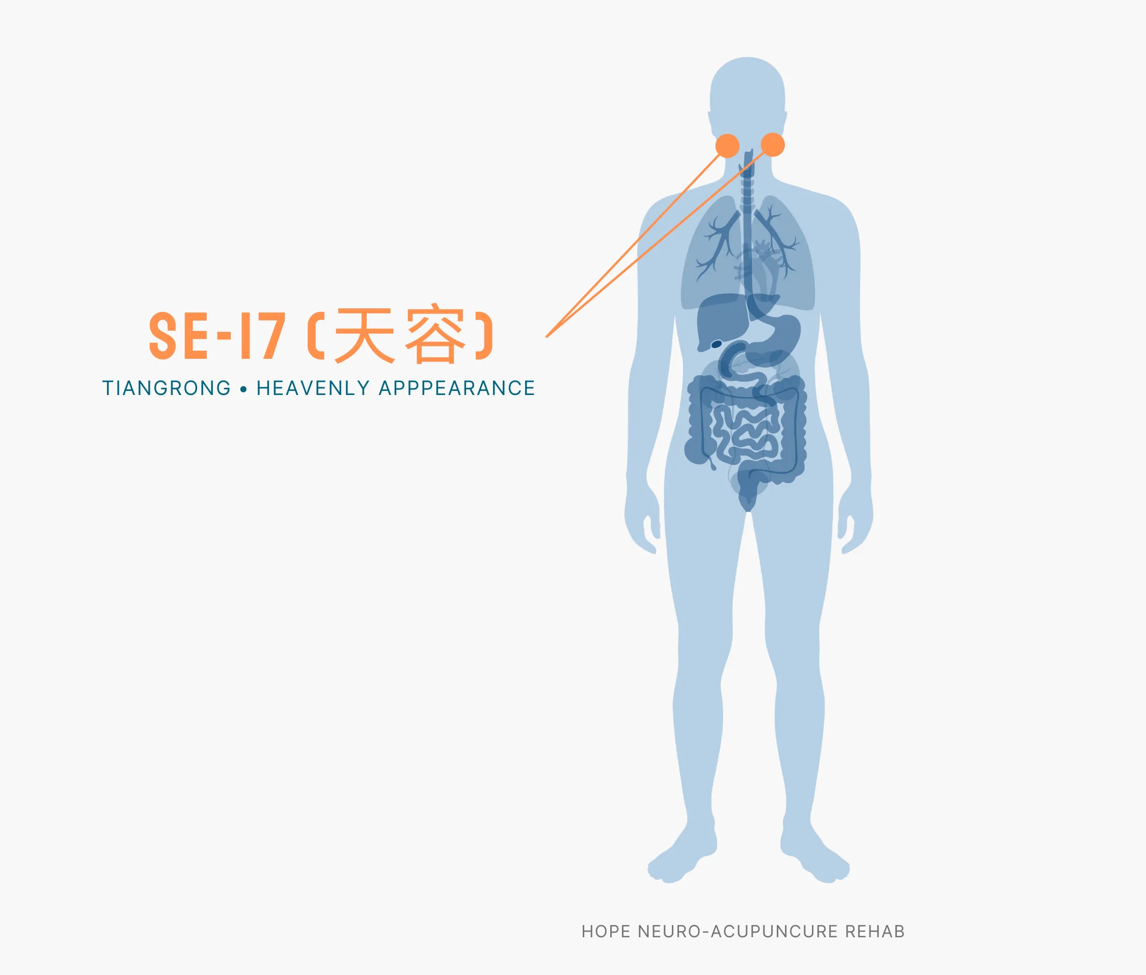 Diagram Showing Where the SI-17 Acupuncture Point (also known as Tiangrong or Heavenly Appearance) is within the Small Intestine Meridians