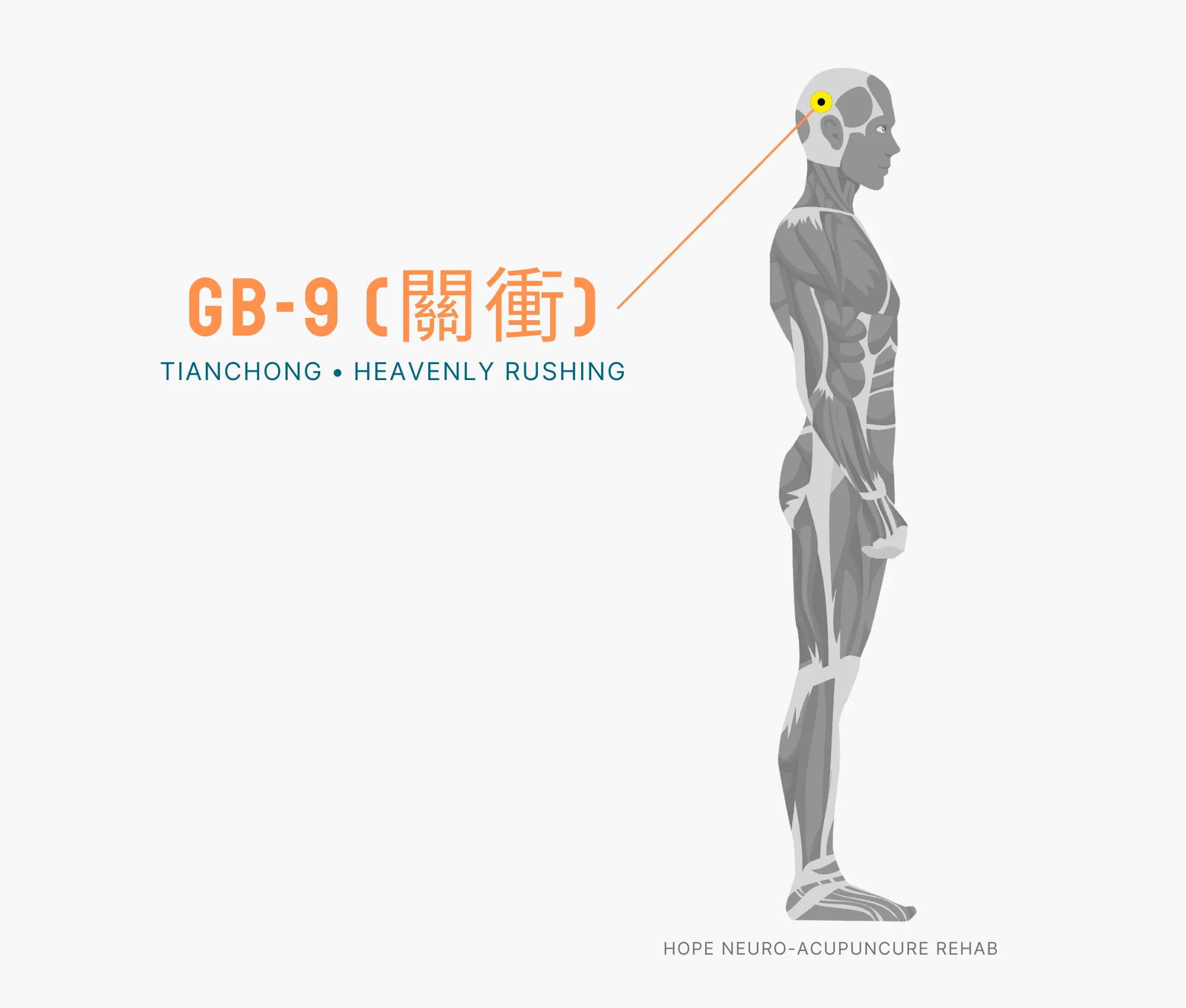 Diagram Showing Where the GB-1 Acupuncture Point (also known as (Tongziliao or Pupil Crevice) is within the Gallbladder Meridian