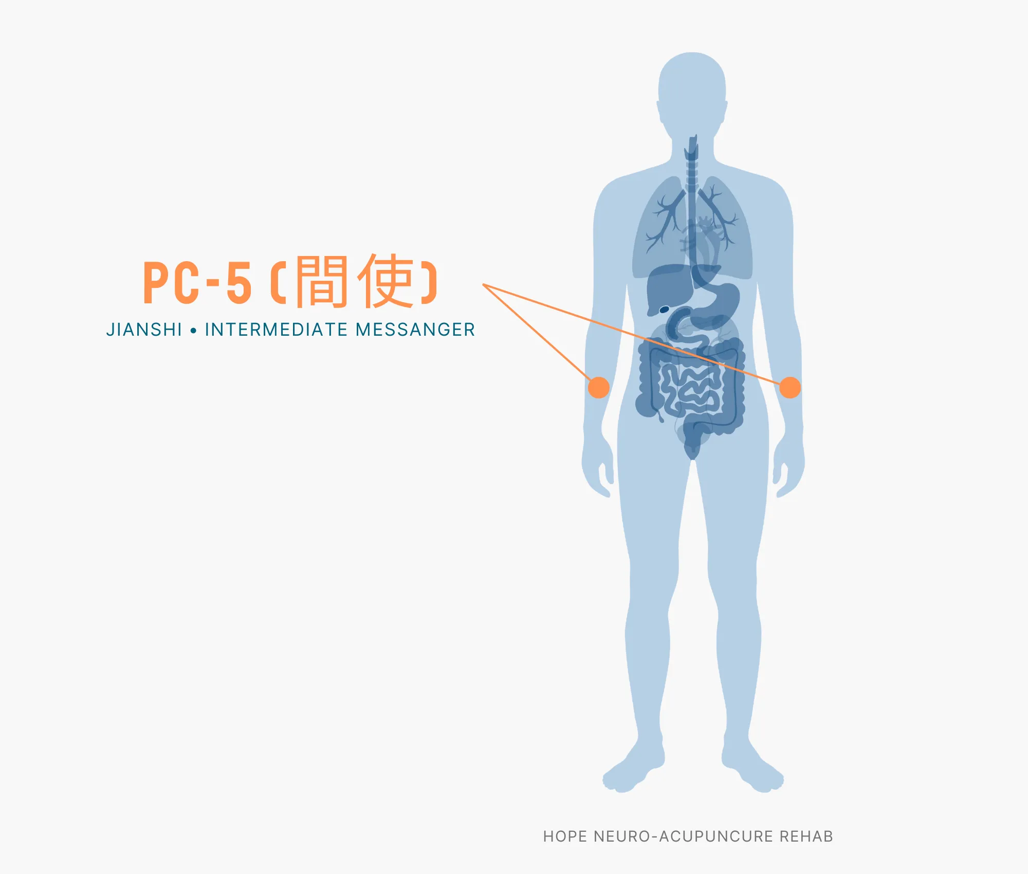 Diagram Showing Where the PC-5 Acupuncture Point (also known as Jianshi or Intermediate Messanger) is within the Pericardium Meridian