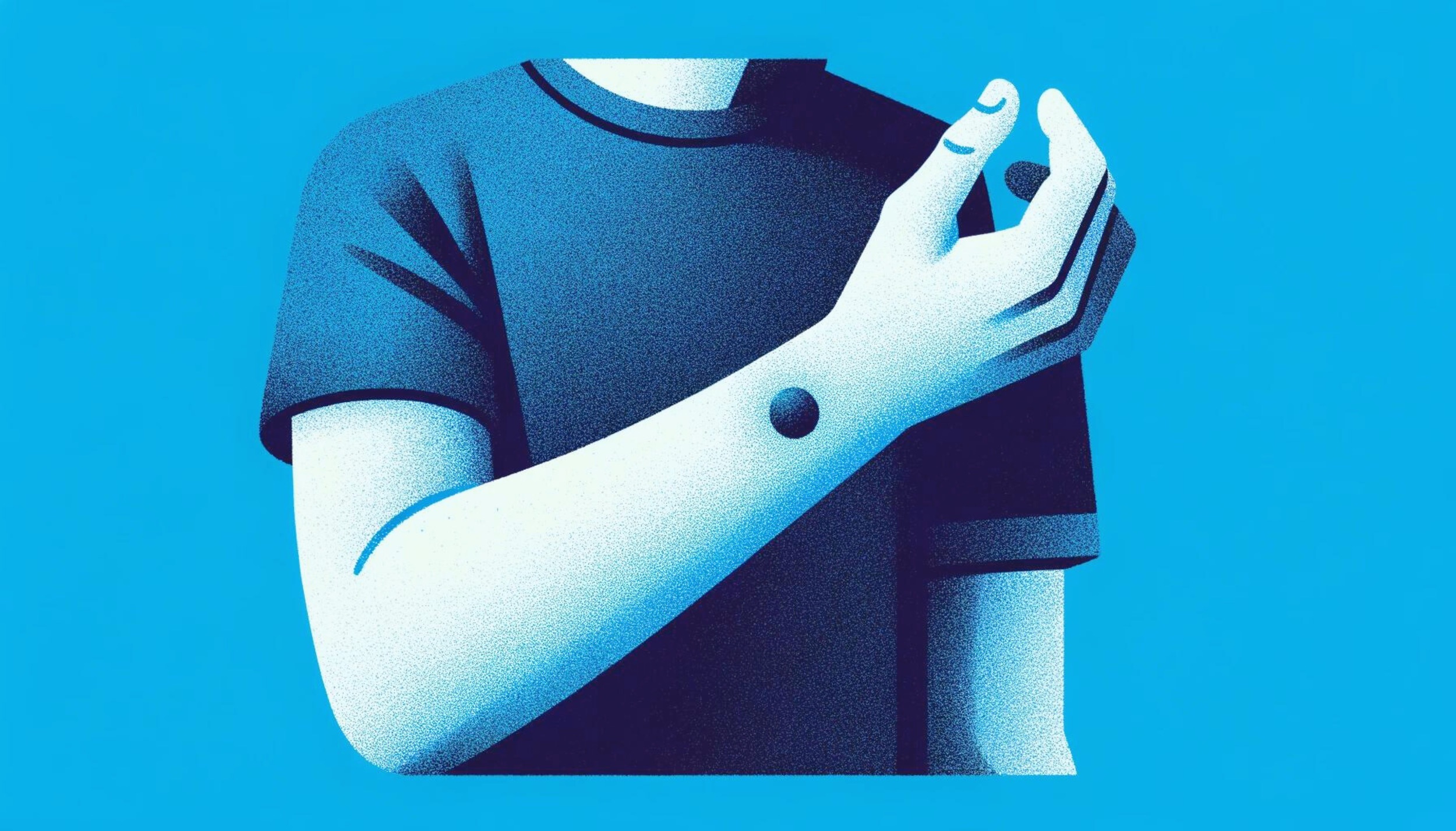 Bruising After Acupuncture: Everything You Need to Know (2024)