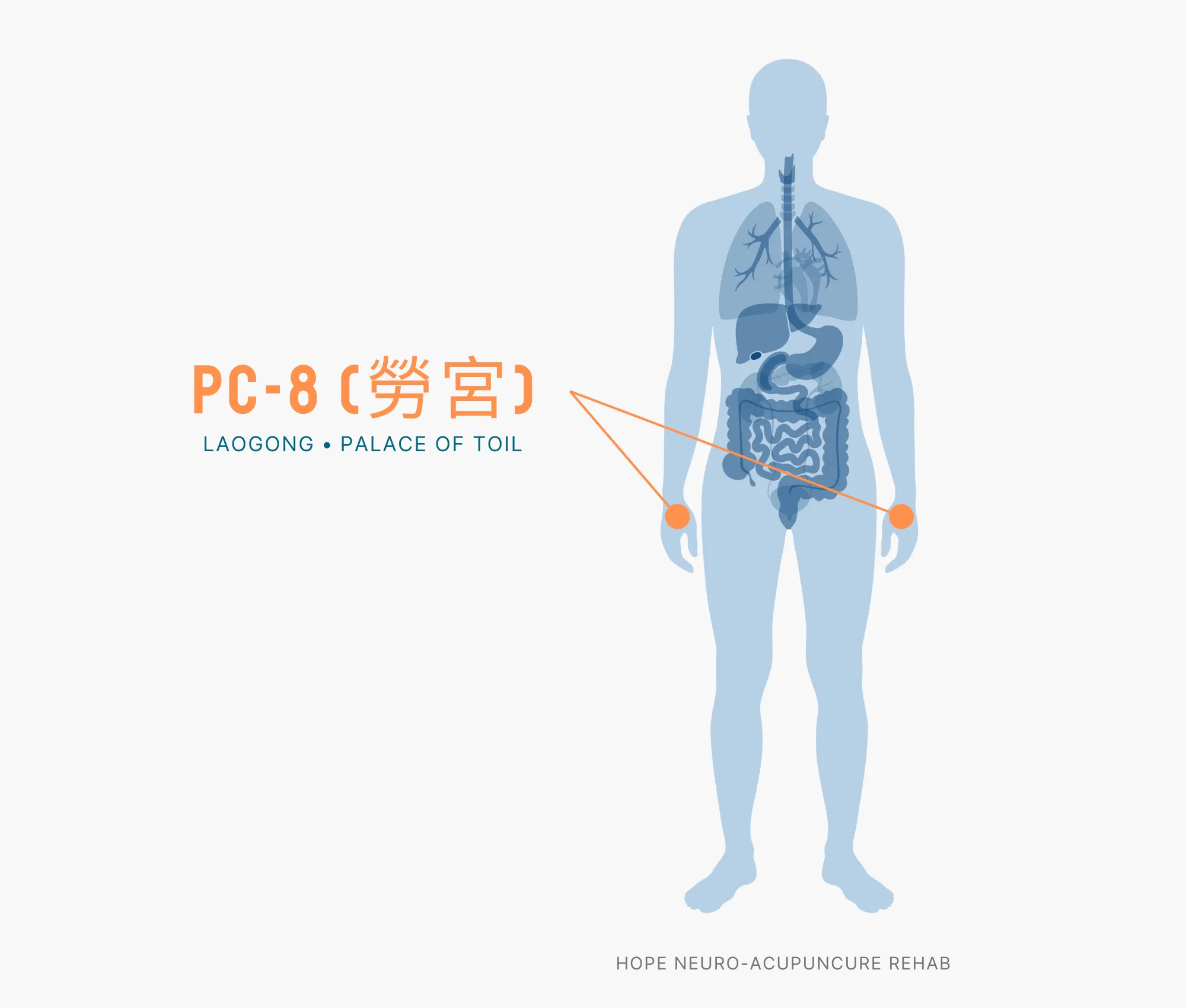 Diagram Showing Where the PC-8 Acupuncture Point (also known as Laogong or Palace of Toil) is within the Pericardium Meridian