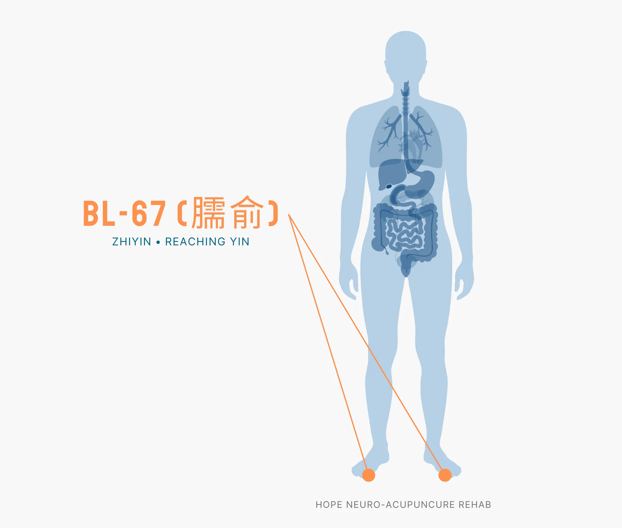 Diagram Showing Where the BL-67 Acupuncture Point (also known as Zhiyin or Reaching Yin) is within the Bladder Meridians