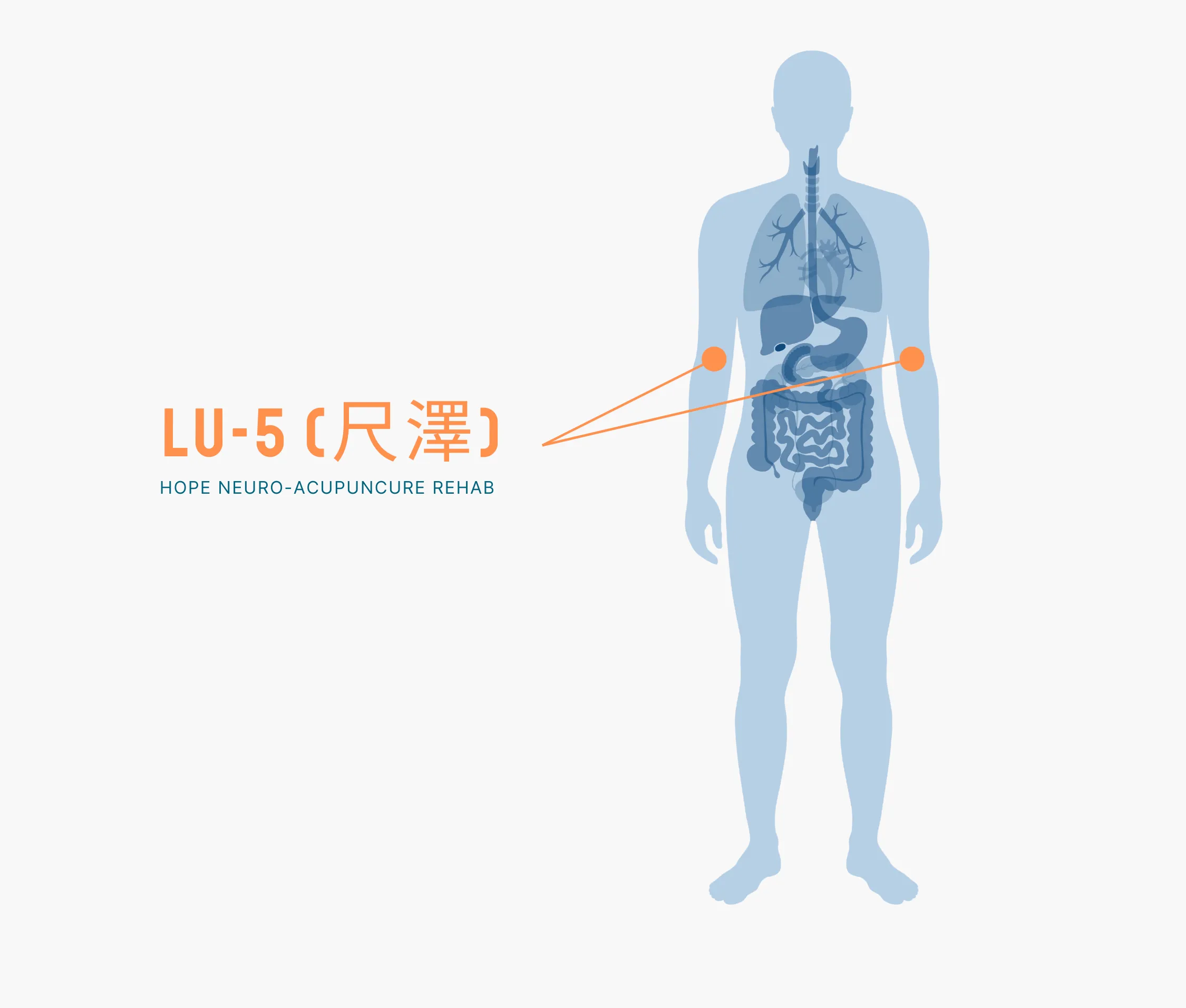 Diagram Showing Where the Lu 5 Acupuncture Point is within the Lung Meridians