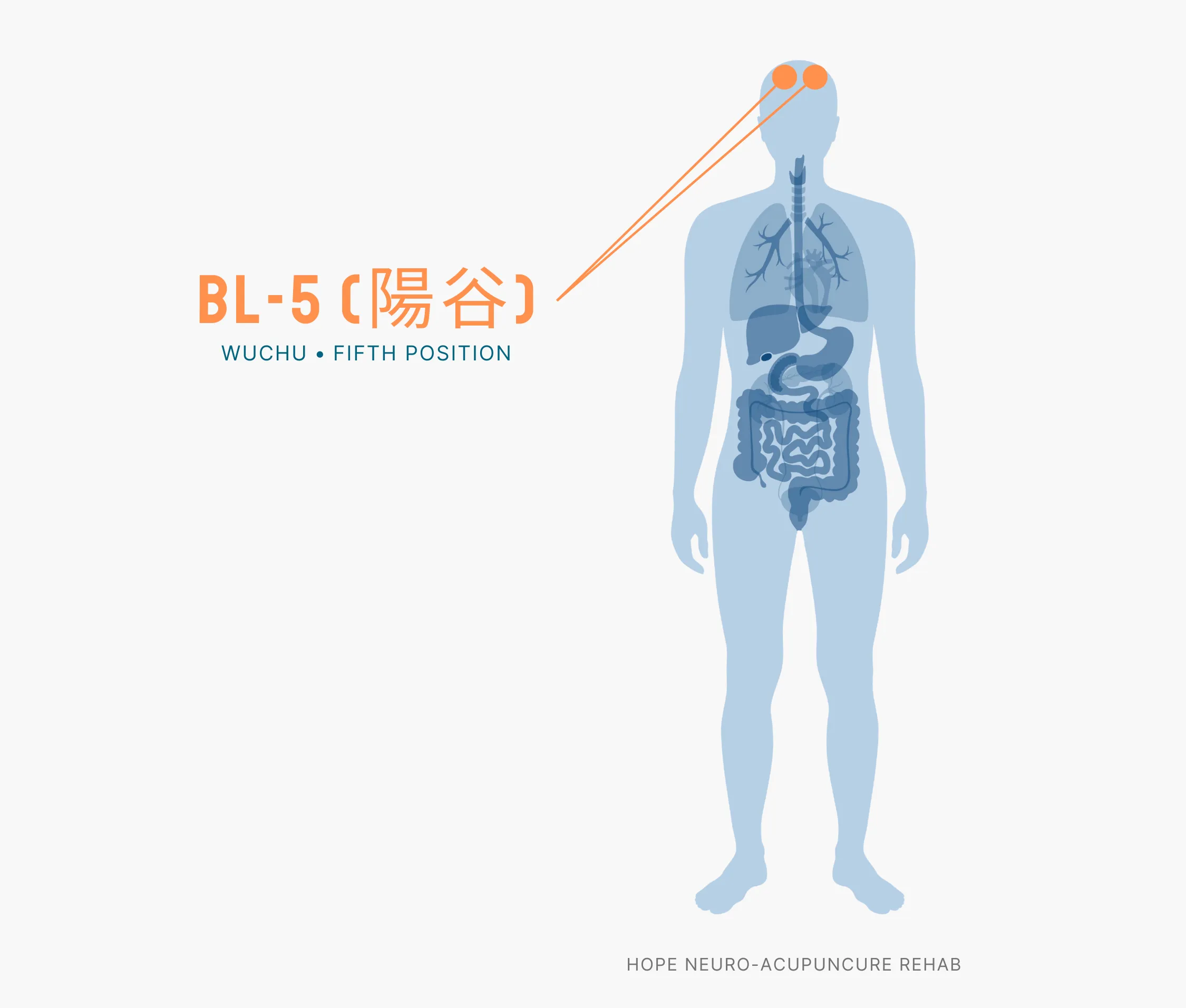 Diagram Showing Where the BL-5 Acupuncture Point (also known as Wuchu or Fifth Position) is within the Bladder Meridians