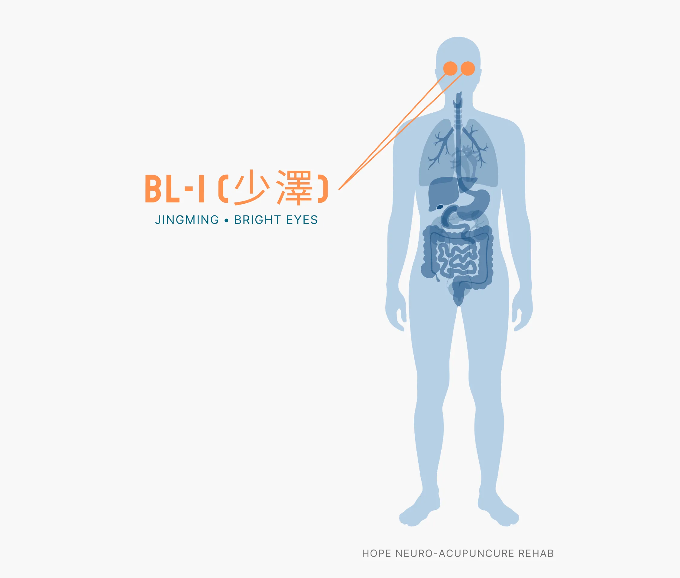 Diagram Showing Where the BL-1 Acupuncture Point (also known as Jingming or Bright Eyes) is within the Bladder Meridians