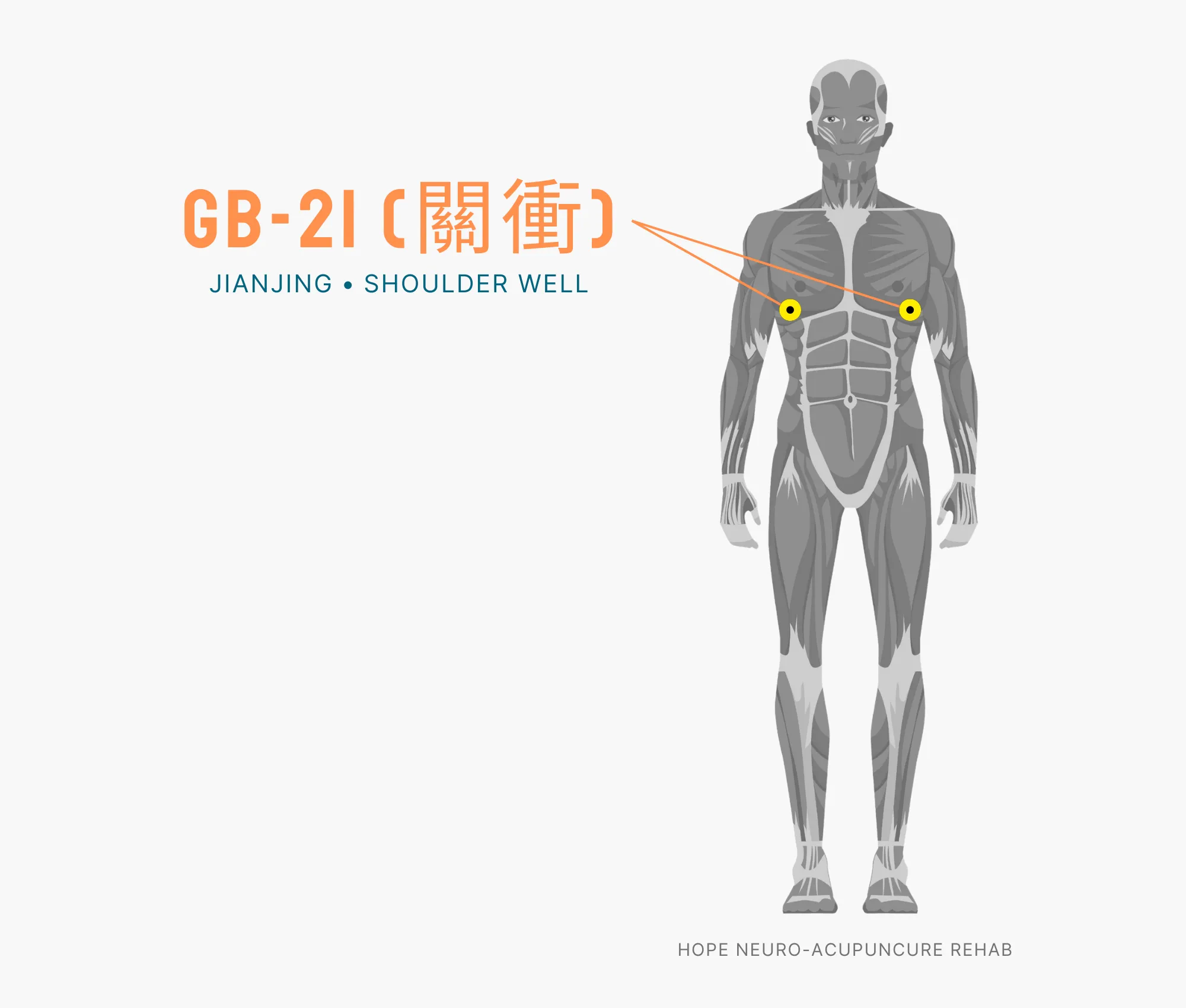 Diagram Showing Where the GB-21 Acupuncture Point (also known as Jianjing or Shoulder Well) is within the Gallbladder Meridian