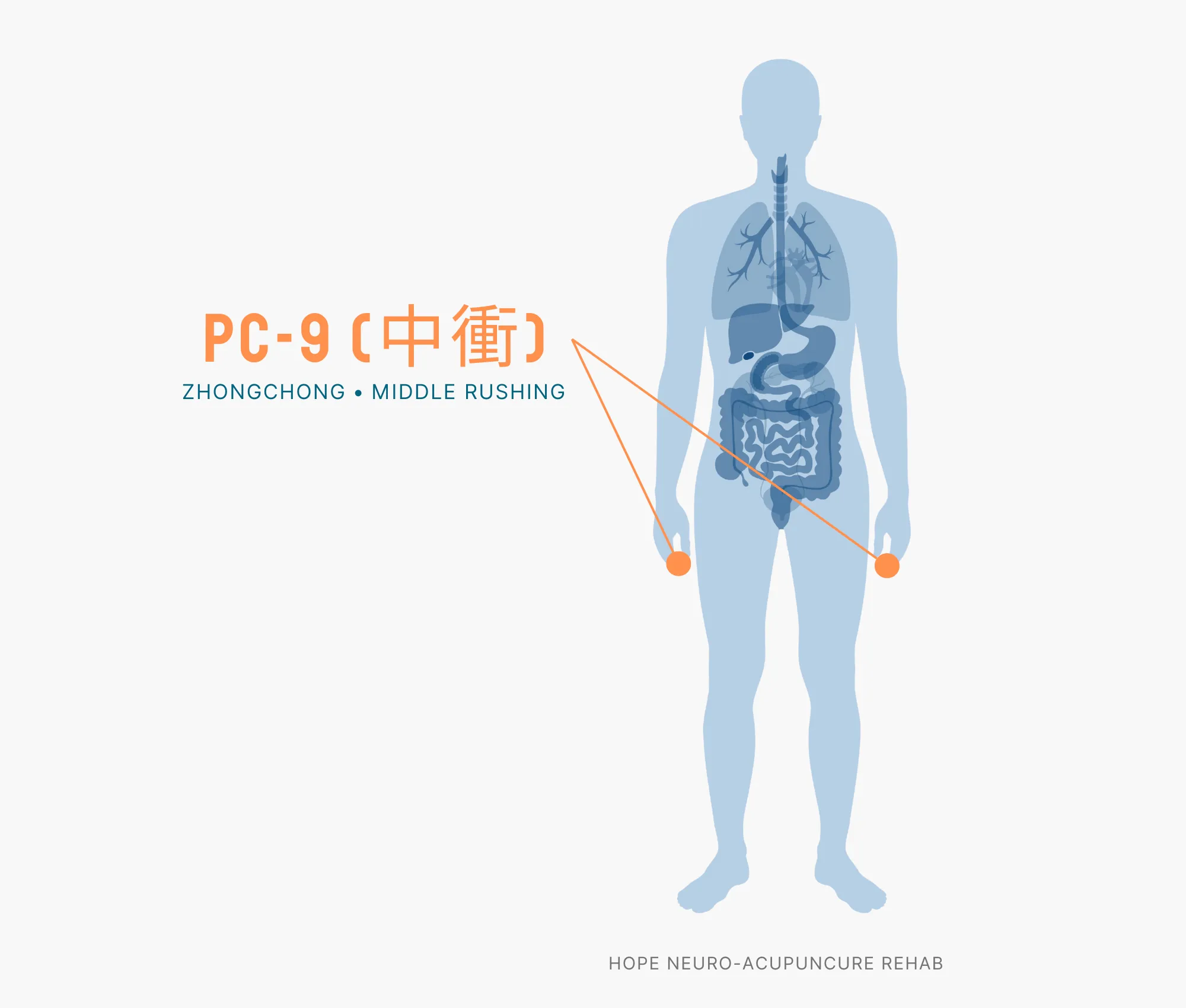 Diagram Showing Where the PC-9 Acupuncture Point (also known as Zhongchong or Middle Rushing) is within the Pericardium Meridian